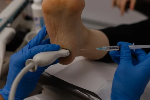 Infiltration (cortisone ou acide hyaluronique)